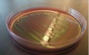 E. Coli bacteria the next source of biofuel? (Image: adonofrio Biology101.org on Flickr)